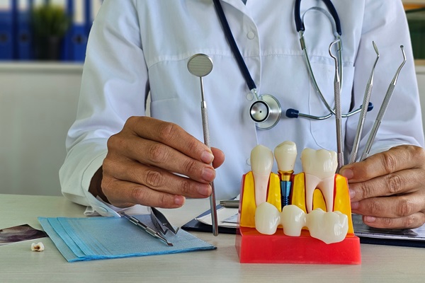 Implant Overdentures From An Implant Dentist